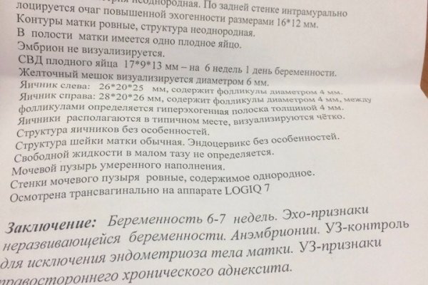Kraken вход и ссылки